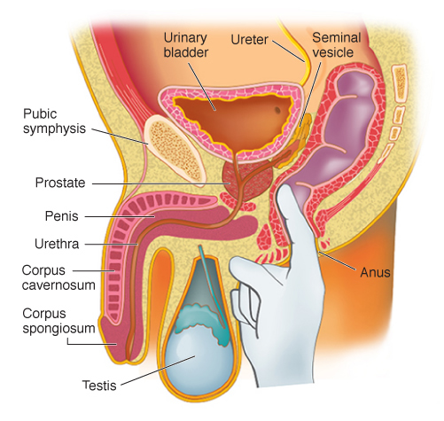 prostate-examination